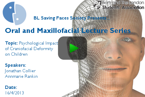 Click here to watch video